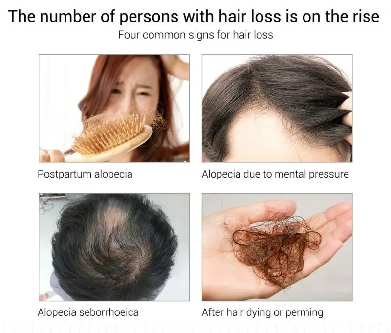 

Fast Powerful Hair Growth Essence Products Essential Oil Liquid Treatment Preventing Hair Loss Hair Care Roots Hair Care 30ml