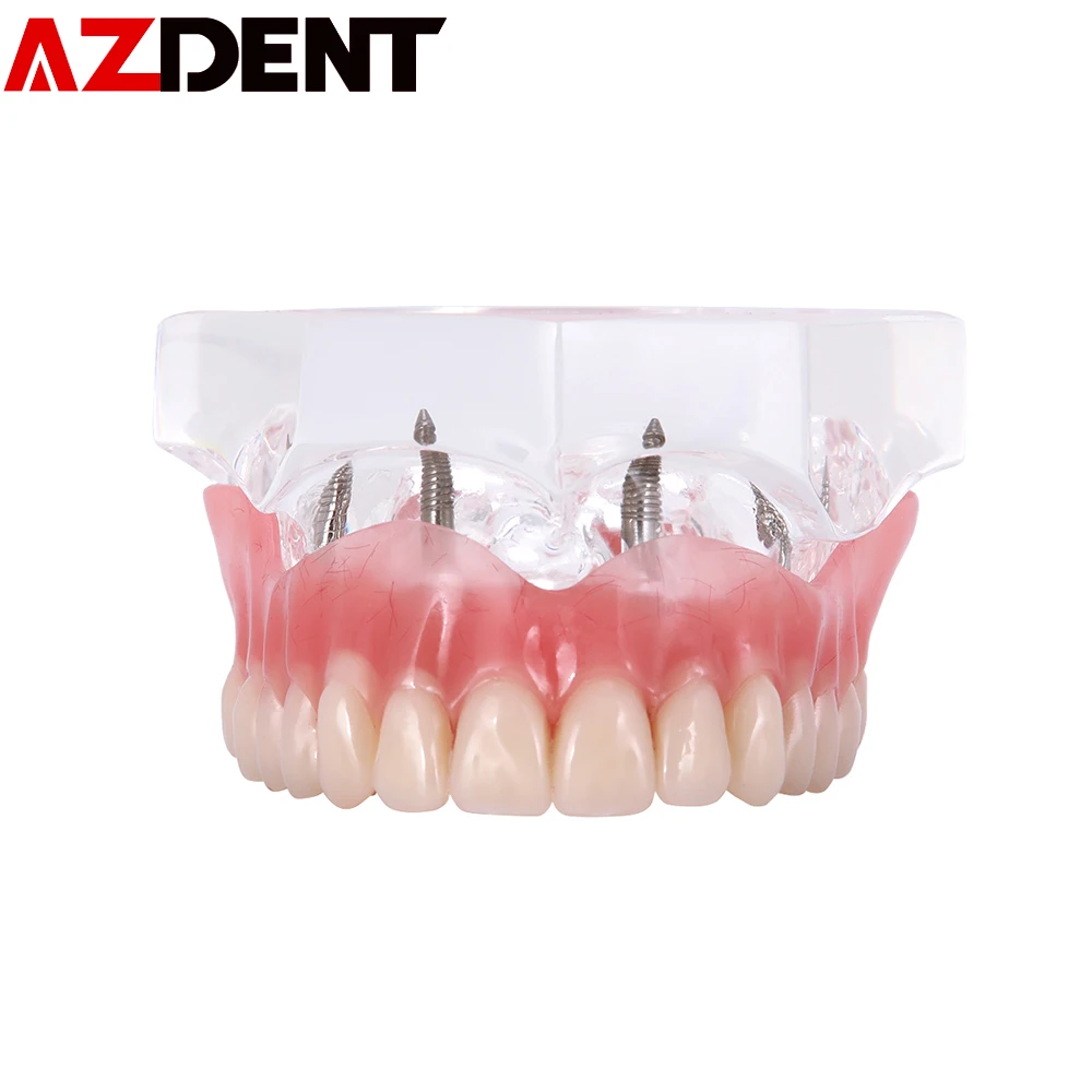 Модель зубных протезов съемная модель внутренней челюстной нижней части зубов