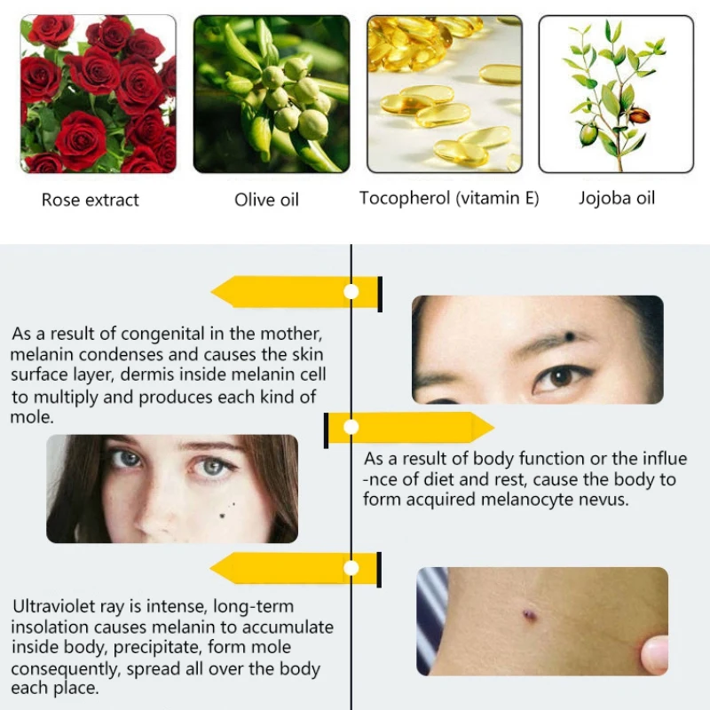 Rose Essential Oil Nourishing Skin Removing Nevus Freckles Facial Lighten Whitening Face Serum | Красота и здоровье