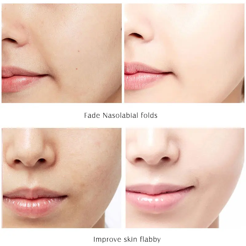 ARTISCARE Platinum + 24k Gold шесть сыворотка с пептидами для лица антивозрастной увлажняющий