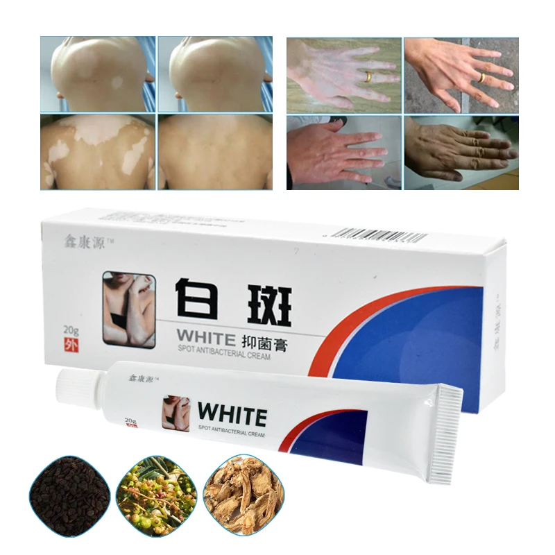 20 г Китайский медицинский крем с белыми пятнами пигмент меланин стимулирующий
