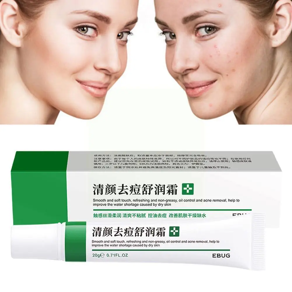 

Acne Removal Cream Freckle Cream Shrink Pores Whitening Care Acne Control Acne Face Skin Cream Treatment Cream Moisturizing T9b3
