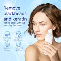 professional handheld skin scrubber remove blackheads and keratin water proof device stainless steel