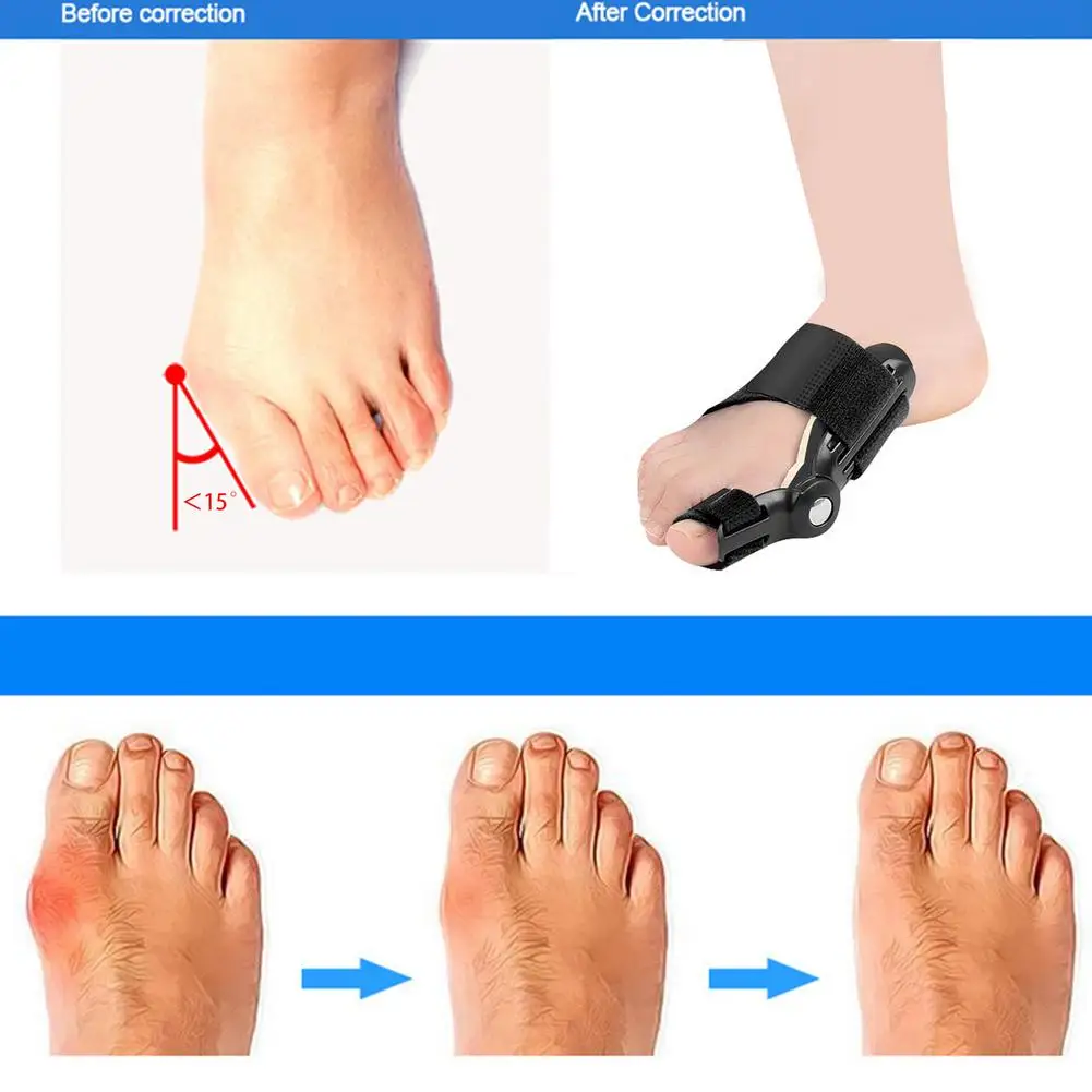 

1Pair Toe Separator Hallux Valgus Corrector Orthotics Feet Bone Thumb Adjuster Correction Pedicure Sock Straightener Dropship