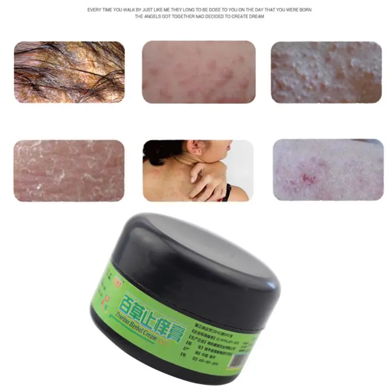 От волдырей 25 г облегчение боли натуральный травяной анти зуд крем экзема мазь