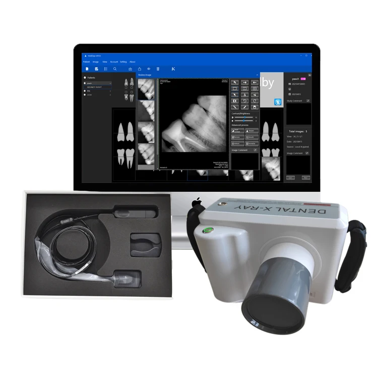 

dental portable x ray machine with cheapest rvg sensor set/dental medical imaging equipment