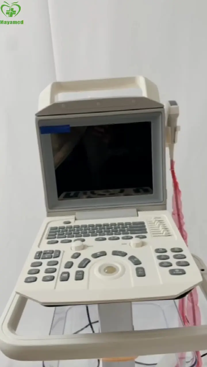 

MY-A005A Portable All Digital Ultrasound System Laptop Machine 12.1 inch High Definition LCD Medical Ultrasound Instruments