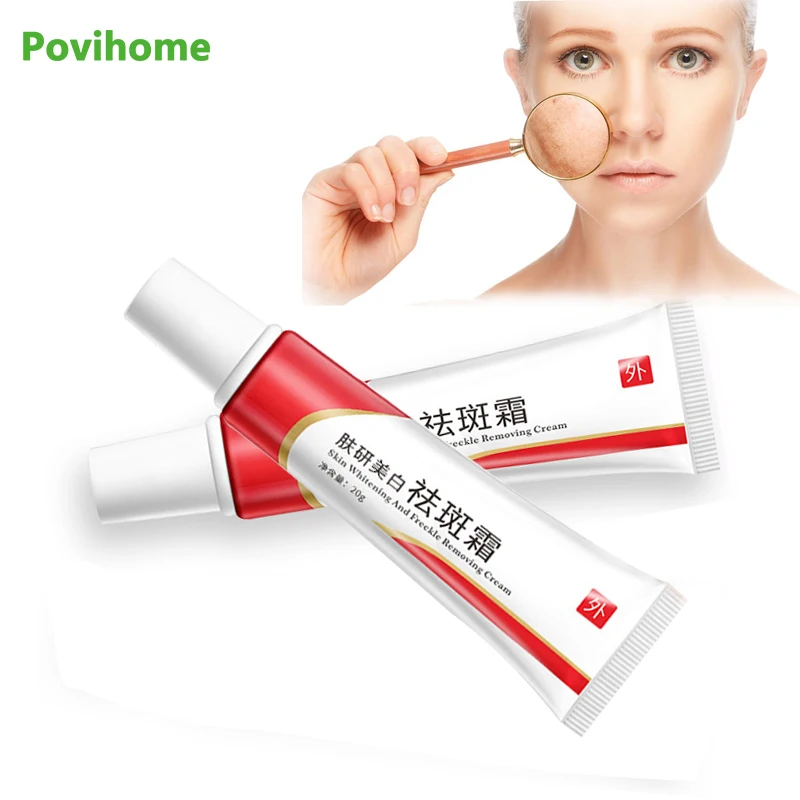1 шт. 20 г уход за кожей лица крем для отбеливания веснушек удаления темных пятен