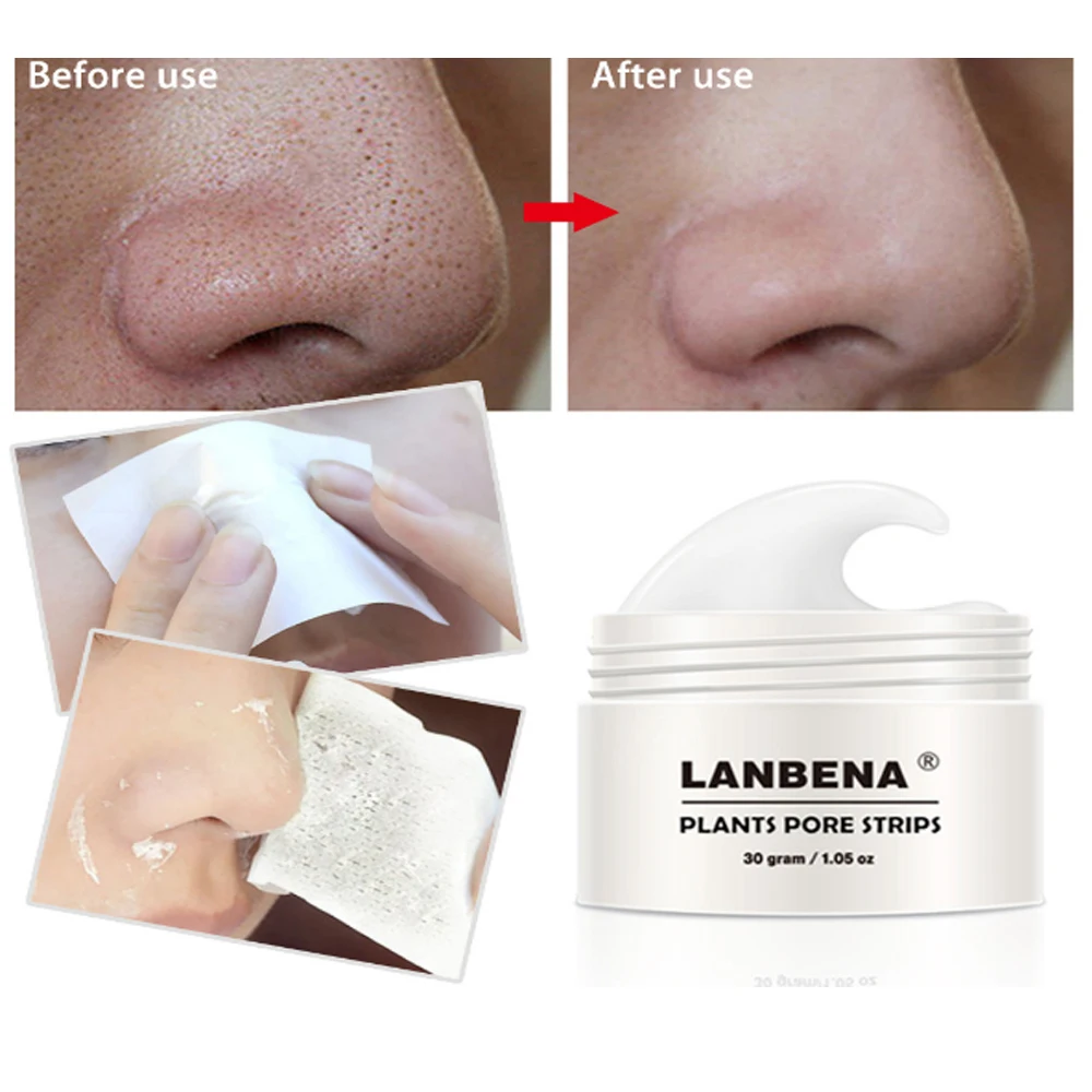 Маска для удаления угрей полоска носа черная маска пилинг лечение акне маски