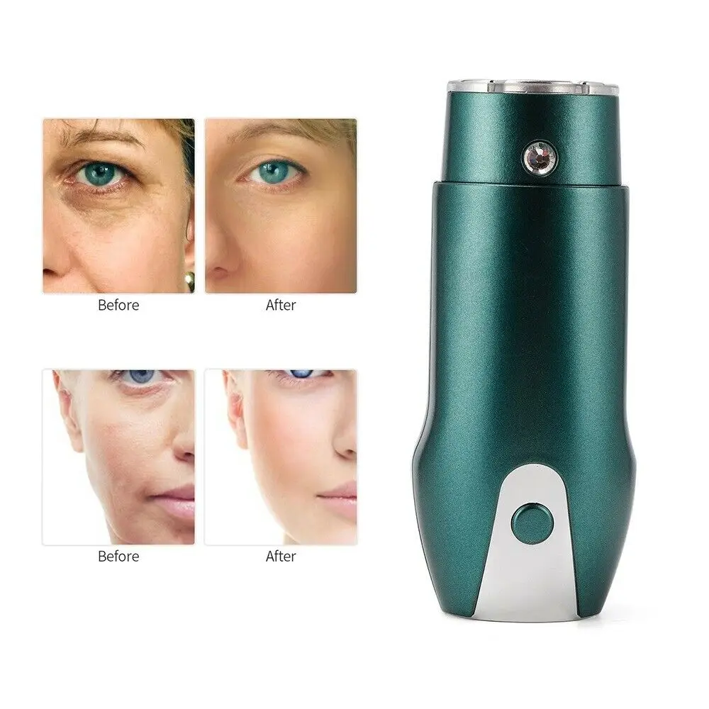 Goede Mini Ultrasone Therapie Gericht Facial Lifting Massager Apparaat Huidverjonging Anti-Rimpel Ems Galvanische Stimuleert Collageen