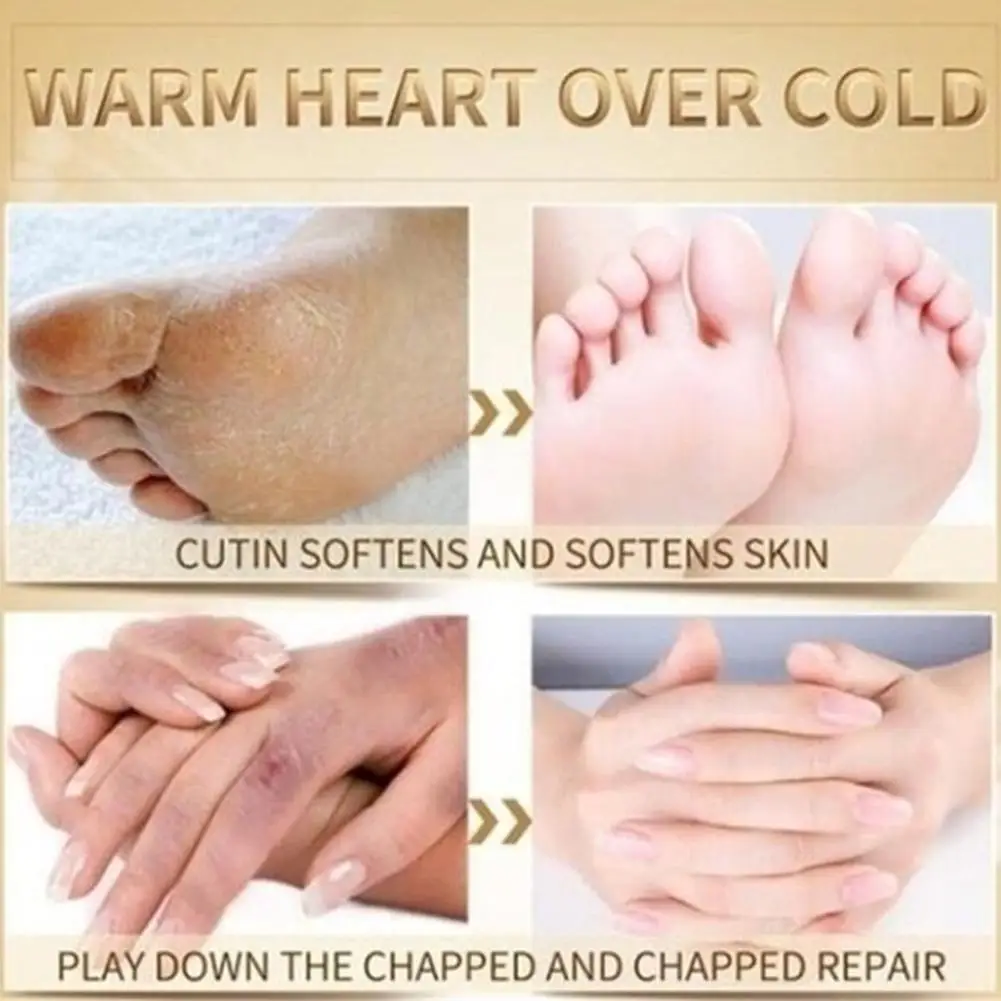 

Lanthome Cleft Foot Urea Cream Moisturizing And Moisturizing 50Ml Care Foot L2N7