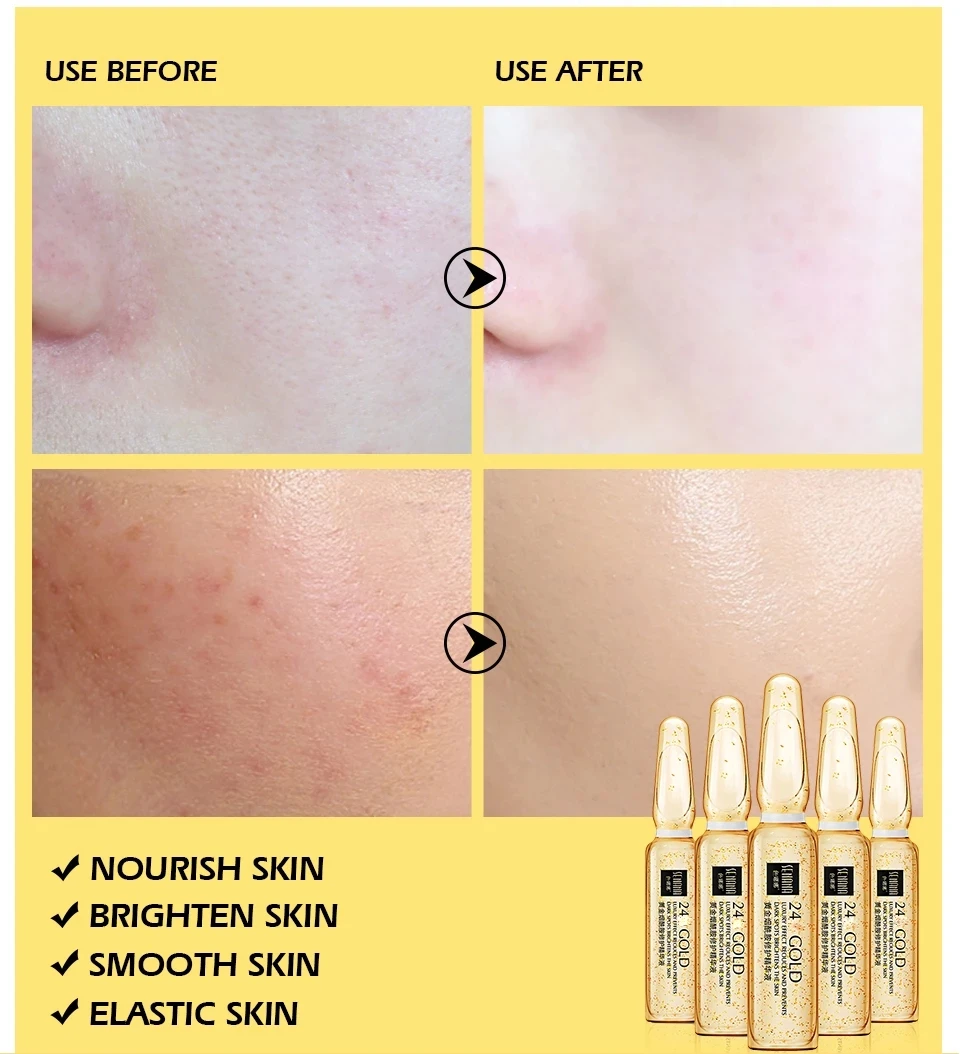 7pcs Hyaluronic Acid Ampoule Face Serum Shrink Pores Anti-Ance Nicotinamide Whitening Injection Moisturizing Wrinkle | Красота и