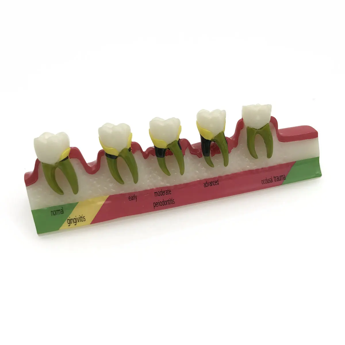 Стоматологический периодонтальный болезни разбирают зуб Typodont модель|model craft|model