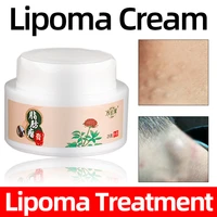 25g fat mass lipoma remove cream multiple removal subcutaneous lipoma plaster health care product