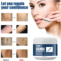 advanced treatment for face body old new scars from cutsstretch marksc sections surgeries skin care scar removal cream