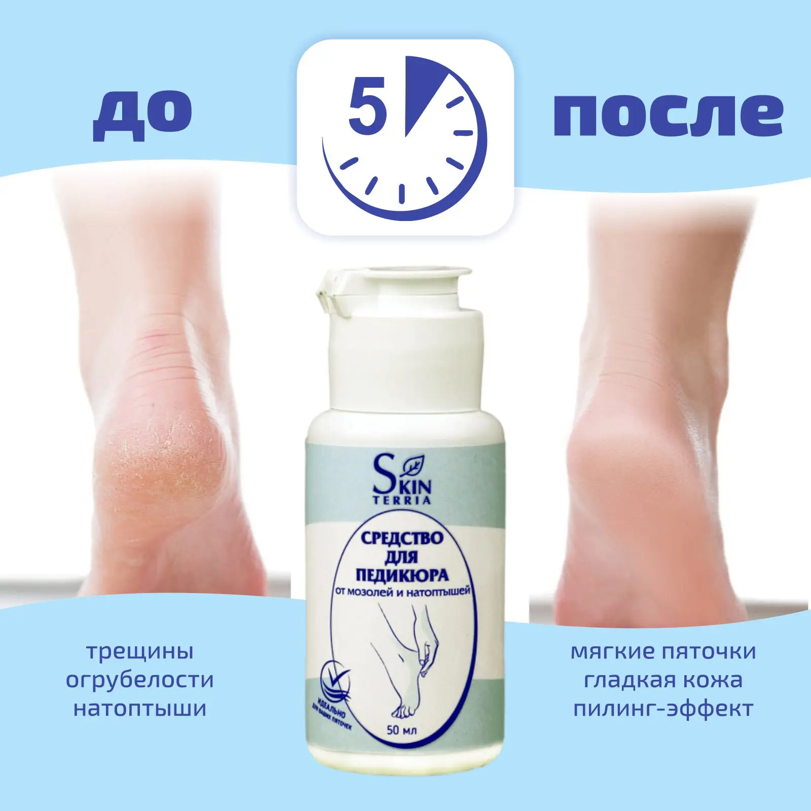 SKINTERRIA Набор средств для педикюра от трещин мозолей натоптышей: Кератолитик и