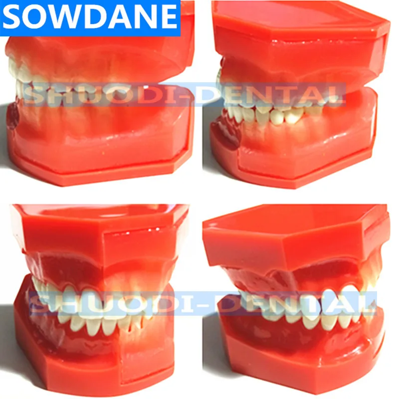 Стоматологическая детская модель выпадающих зубов сменная постоянные зубы
