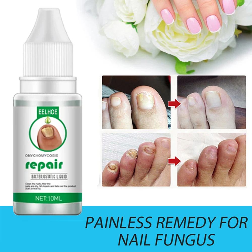 10мл/20мл/30мл Сыворотка для лечения грибка ногтей, восстановления ногтей, стимулирования роста и укрепления треснувших ногтей.
