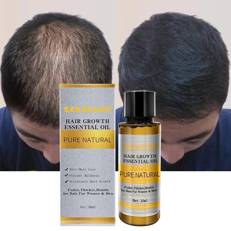 

For Hair Care Hair Growth Essential Oils Essence Original Authentic 100% Hair Loss Liquid Health Care Beauty Dense Hair Growth