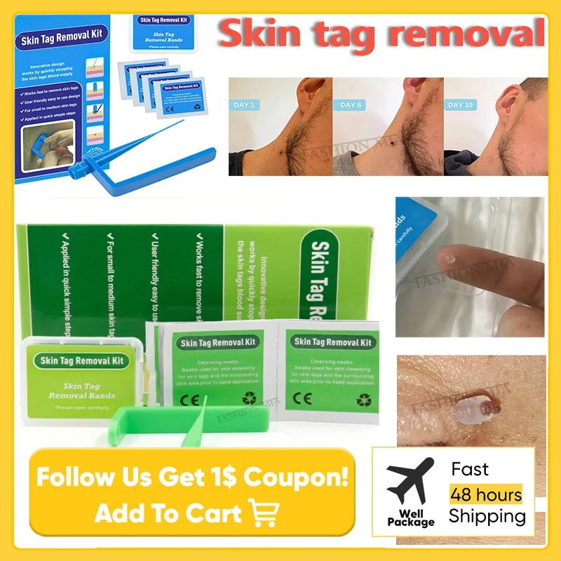 Инструмент для удаления папилломы ухода за лицом малого и среднего размеров