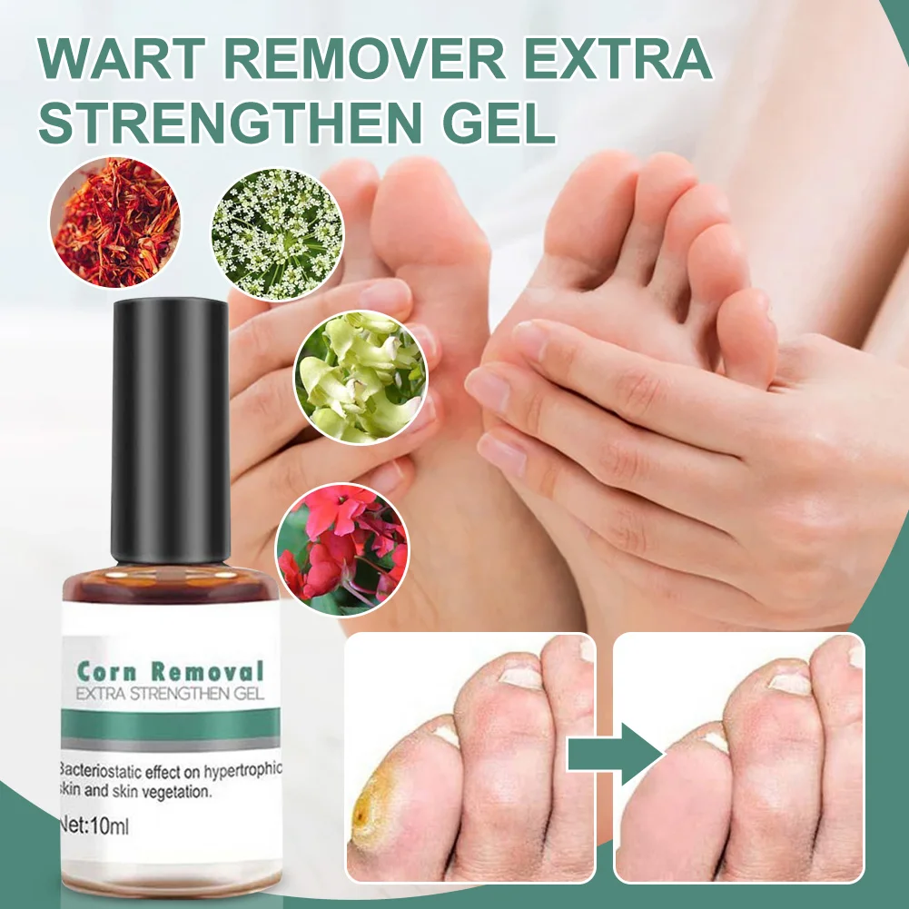 

10ml Wart Removal Serum Painless Non-irritating Effective Skin Tag Wart Corn Callus Treatment Natural Wart Remover Repair Serum