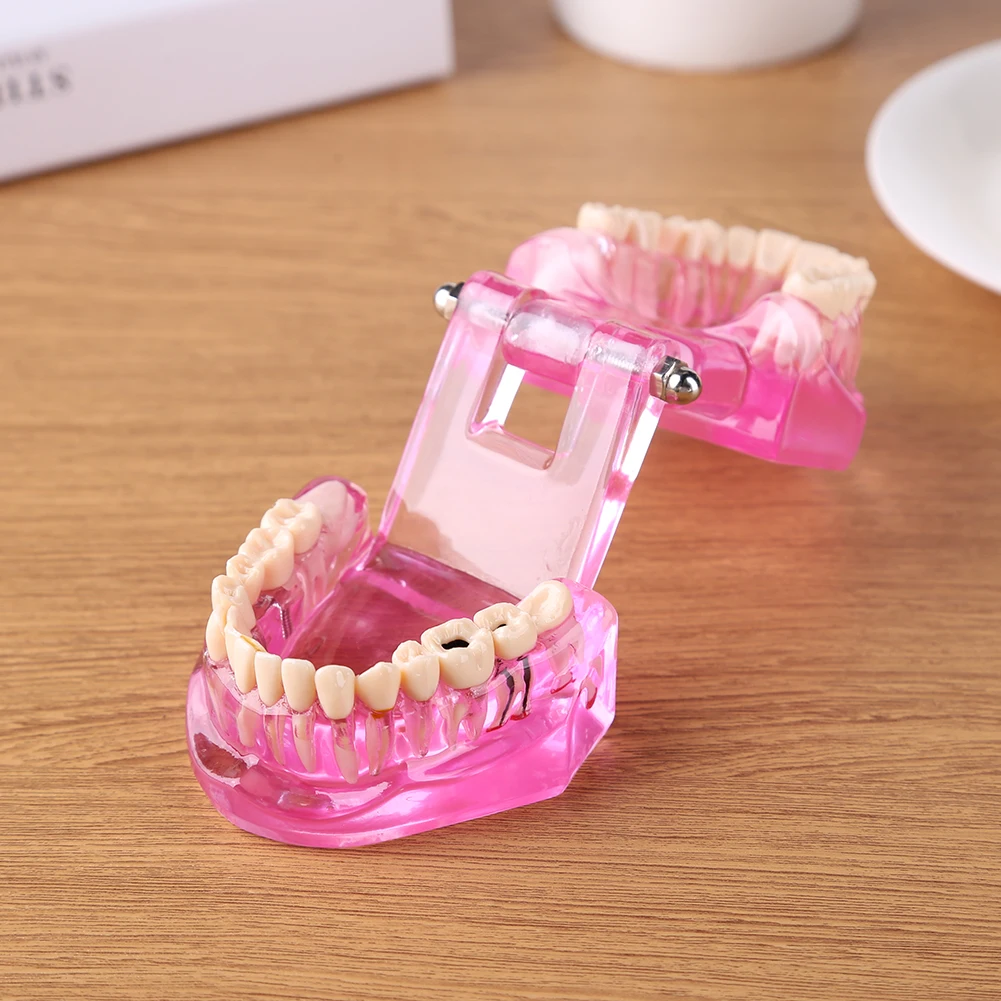 

Dental Orthodontic Model Resin Oral Teeth Model for Oral Health Medical Teaching