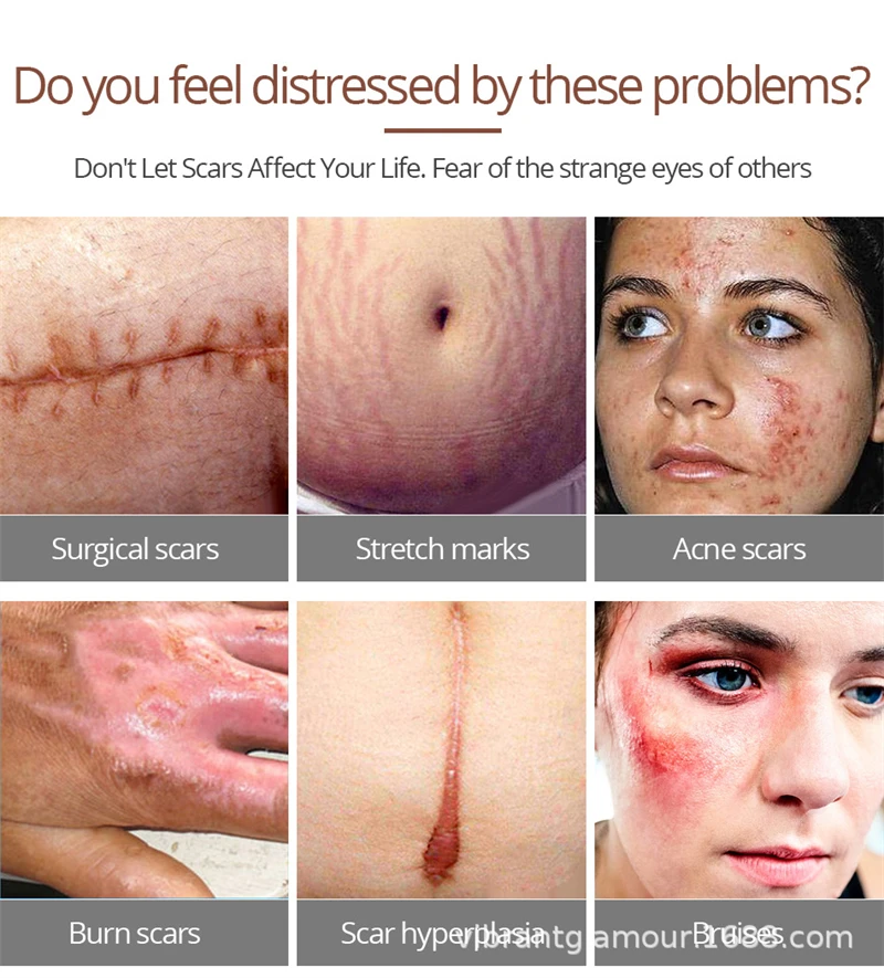 Отбеливающая Сыворотка для кожи крокодила 15 мл | Красота и здоровье