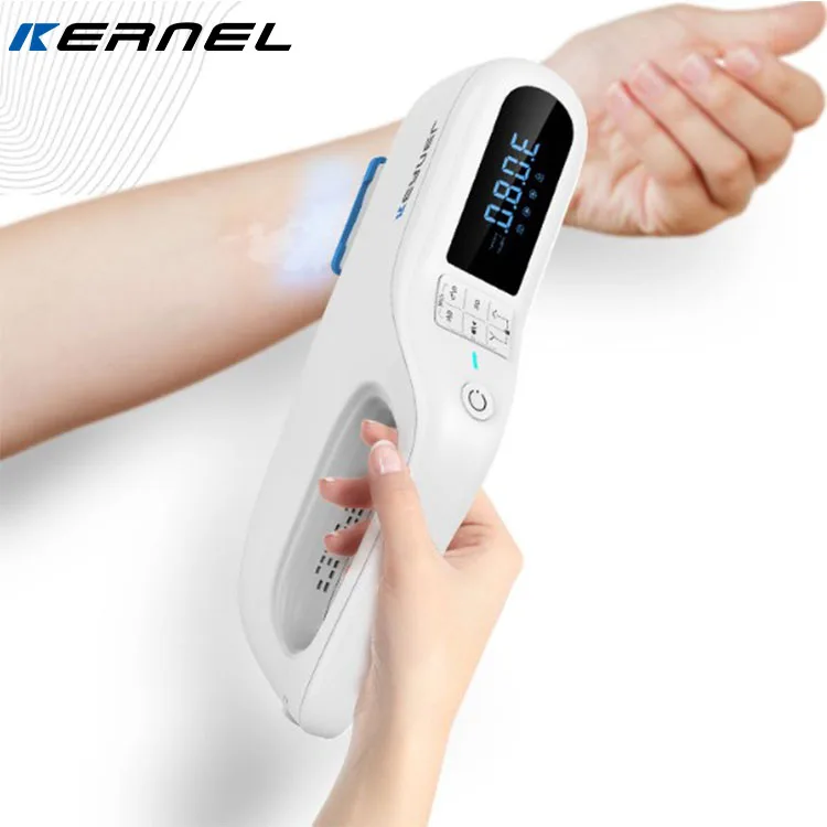 

New Handheld 308nm UVB Phototherapy 308 nm excimer laser UV Photothearpy Vitiligo Treatment