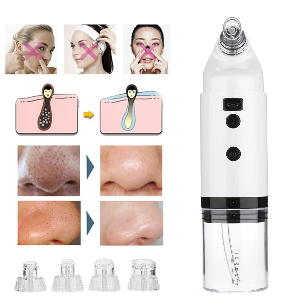 Аппарат для удаления чёрных точек со светодиодсветильник | Красота и здоровье