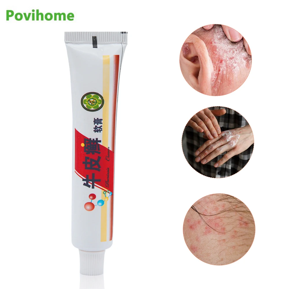 1 шт. 20 г кремов для псориаза мазь тела дерматит облегчающий зуд из трав