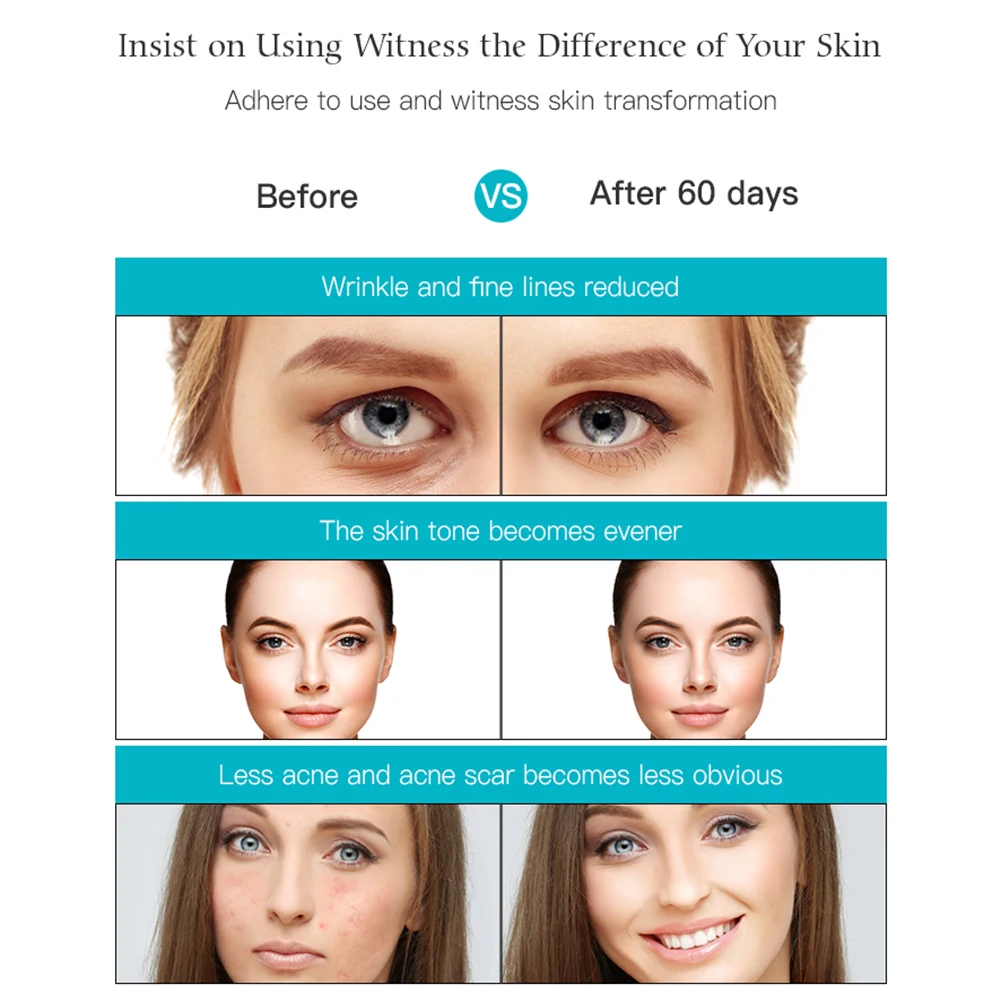 

100 LED Facial Mask Skin Rejuvenation Light Therapy Anti Aging Face Mask Korean Beauty Machine Whitening Neck Skincare Tool