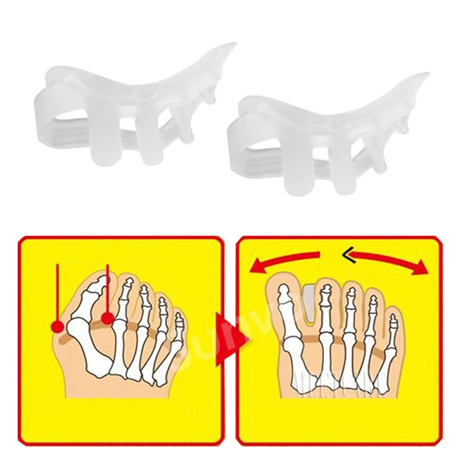 Sunvo Hallux Valgus Orthotics Bunion Splint for Separate All Toe Big Bone Orthopedic Foot Hammer Corrector Separator Inserts Pad