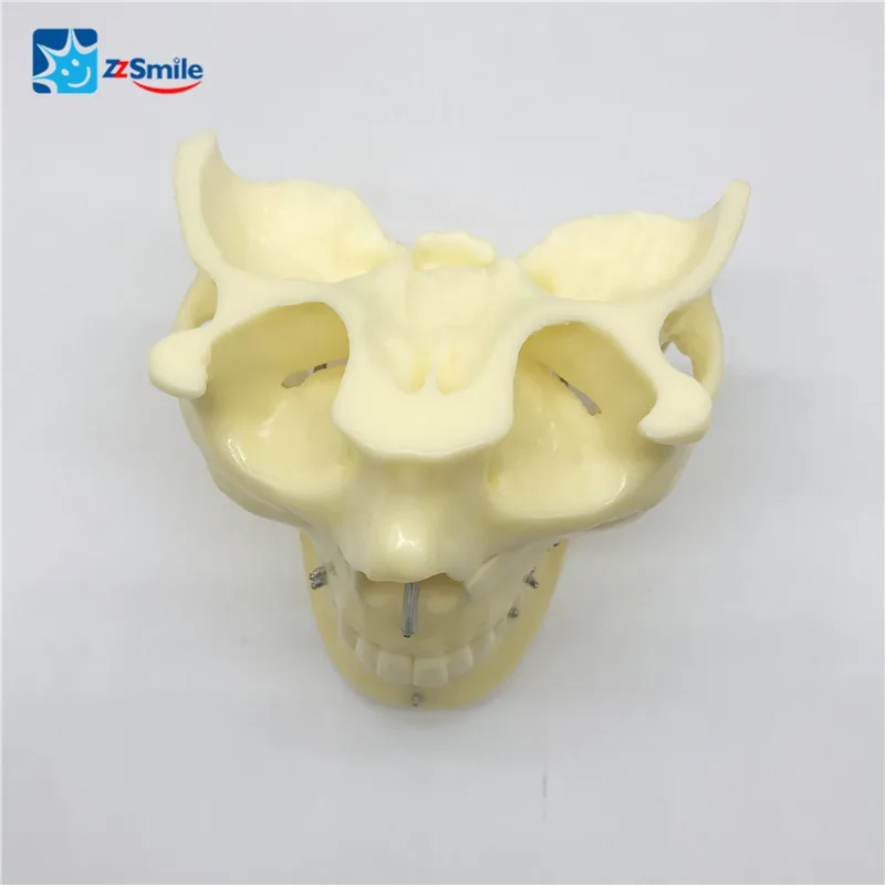 

Dental M2016 Plastic Implant Practice Model Dental Model