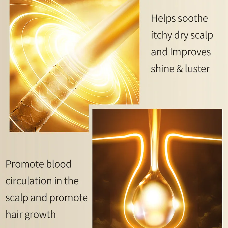 Hair Growth Serum Prevent Loss Fork Promote Regeneration Scalp Care Repair Deep Nourishment Oil Control Anti-Dandruff 30ml |