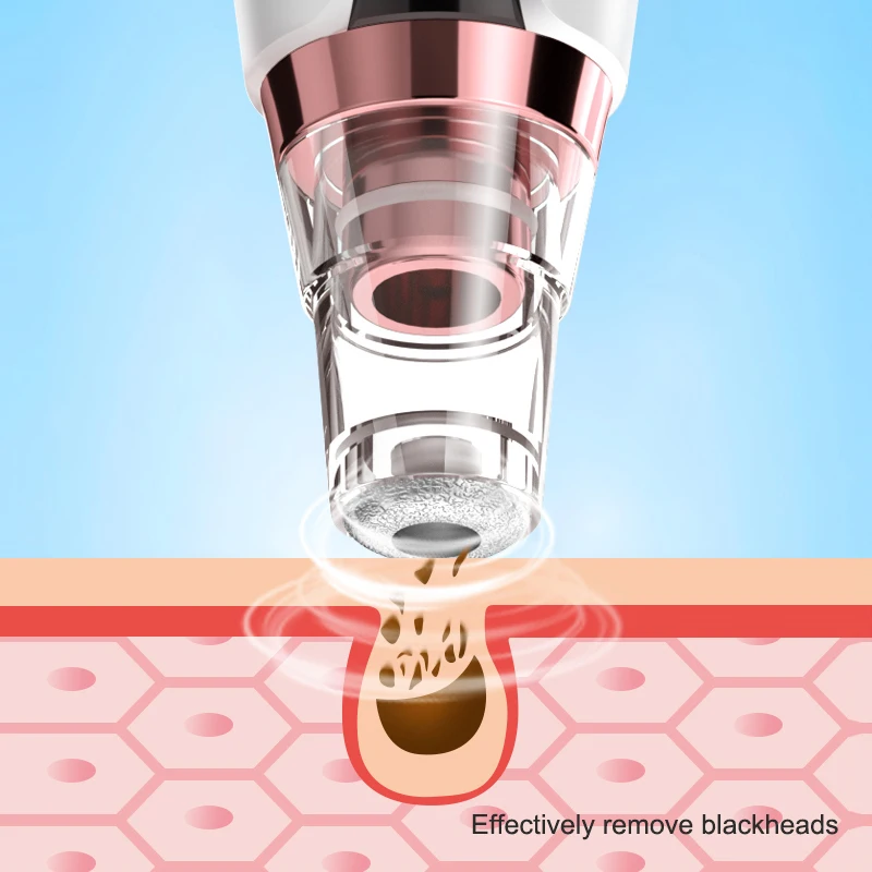 

Black Point Vacuum Cleaner Blackhead Blemish Removers for Blackheads Pore Acne Removal Tool Removing Pores Pimple Remover Tools