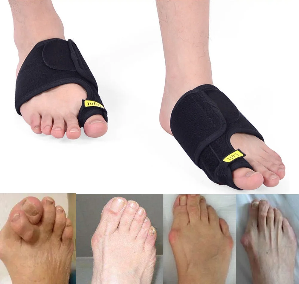 Корректор Bunion выпрямитель для пальцев ног и корректор облегчение боли