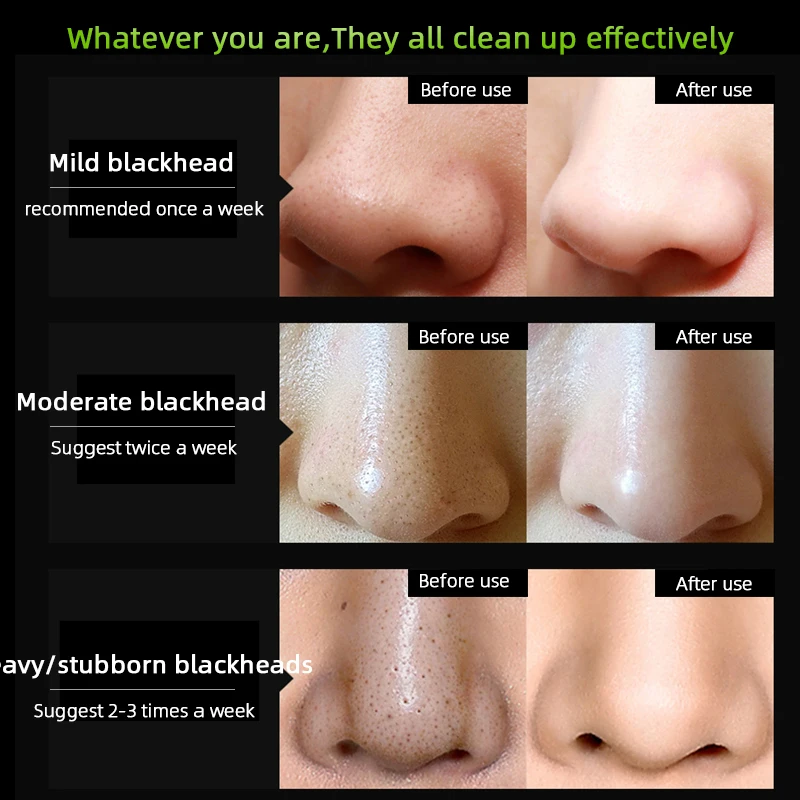 Бамбуковая угольная маска для лица удаление черных точек прыщей контроль