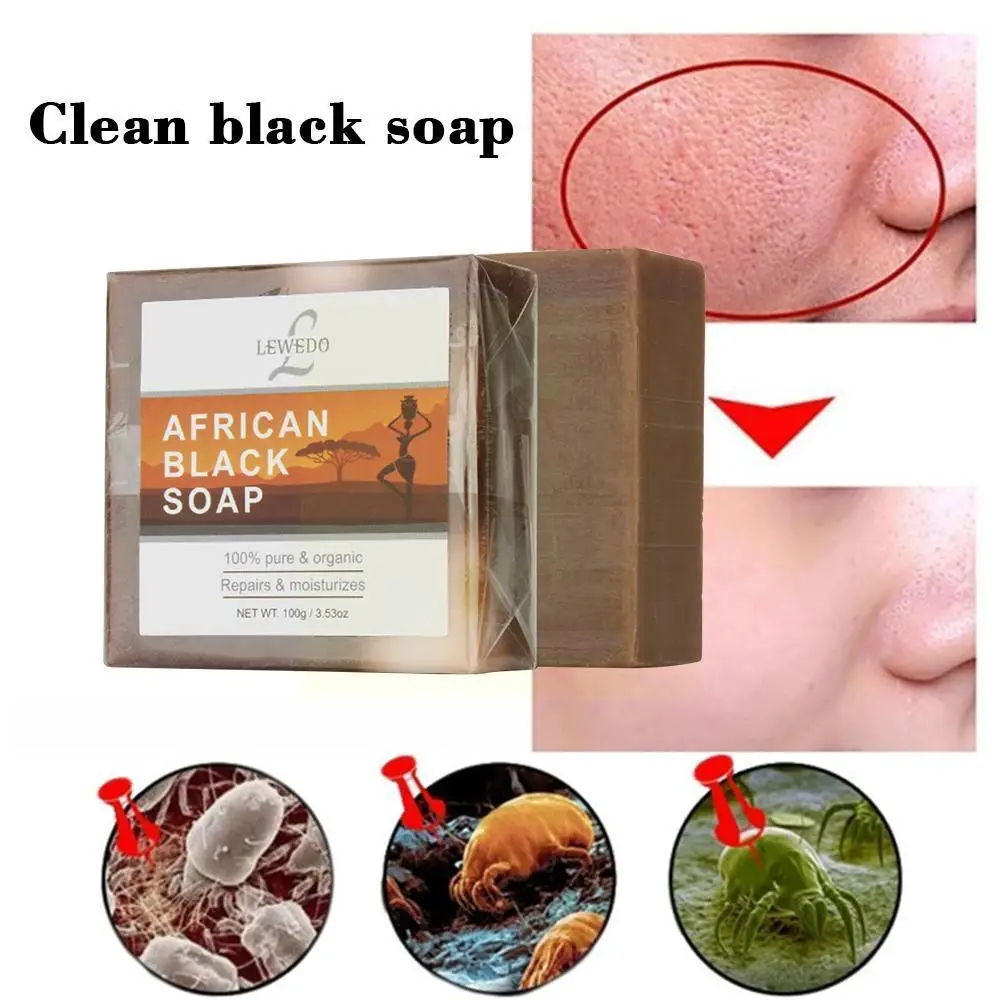 

African Natural Black Soap Antibacterial Whitening Skin Soap Face Acne Skin Care Body Soap Treatment Z7o7
