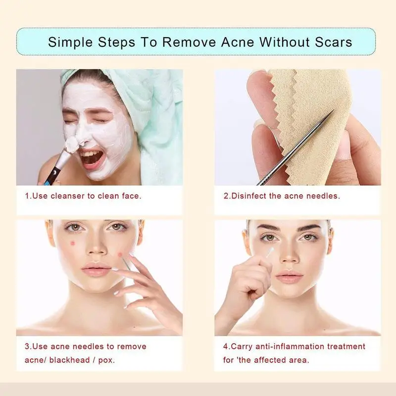 Иглы для удаления черных точек игла прыщей и набор чистки пор | Красота здоровье