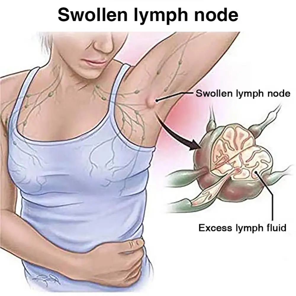 50% горячая распродажа 10 шт. травяные детоксикационные пластыри продвижение
