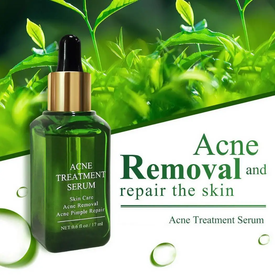 Угревая угревая головка усадка поры ремонт Сделано Китай маска для носа против