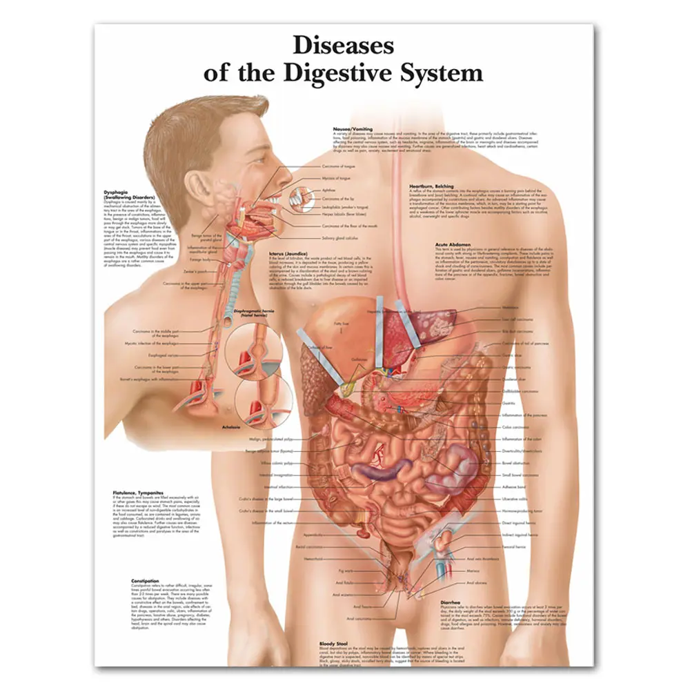 Изображения пищевая система анатомические карты и постеры настенные картины
