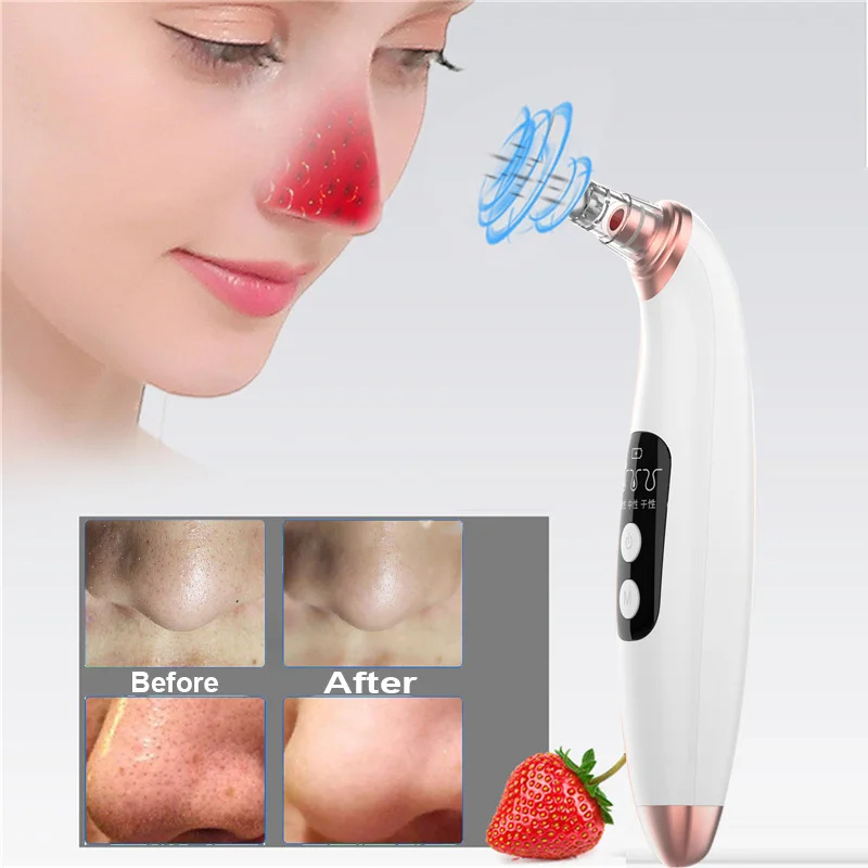 Средство для удаления угрей уход за кожей лица глубокое очищение пор Удаление