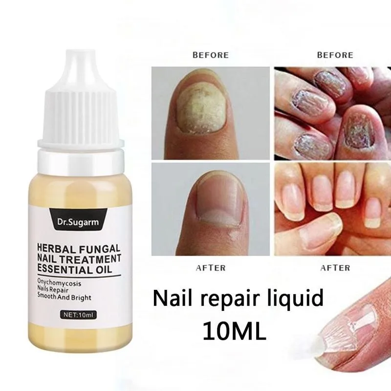 

Dr.Sugarm 10ML Nail Repair Liquid Fungal Nail Repair Essence