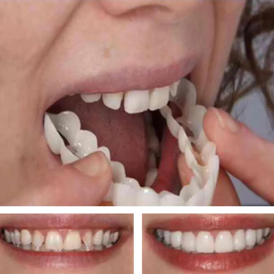 5 шт. косметические виниры для имитации зубов|Отбеливание зубов| |