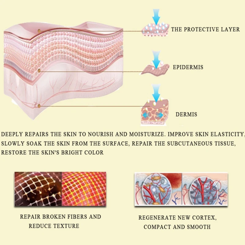 

Rose Pregnancy Cream Remove Stretch Marks Paste Anti Wrinkle Anti-Aging Maternity Skin Repair Remove Scars Treatment Skin Care L