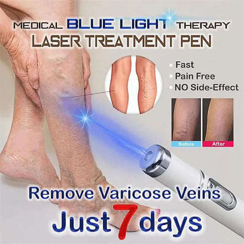 

Heath Blue Light Therapy Varicose Veins Treatment Laser Pen Soft Scar Wrinkle Removal Treatment Acne Laser Pen Massage Relax