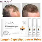 Спрей OMYLADY против выпадения волос, 60180 мл, эфирное масло, жидкость для мужчин, женщин, мужчин, восстановление сухих волос, восстановление волос