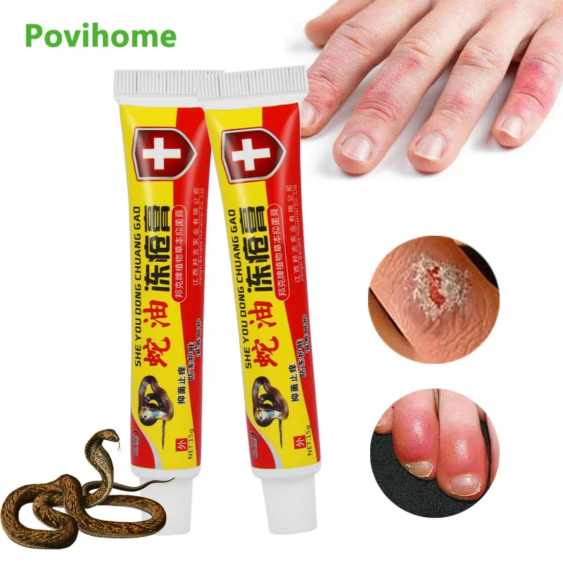 

1/3Pcs Snake Oil Hand Foot Crack Cream Heel Chapped Peeling Foot And Hand Frostbite Anti Dry Crack Skin Care Repair Ointment