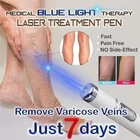Лазерная ручка для лечения варикозного расширения вен с голубым светом, мягкое крем для удаления шрамов лечение морщин, лечение акне, массажная ручка